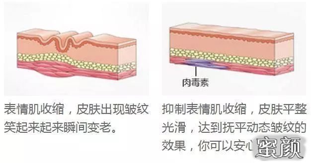 案例图片