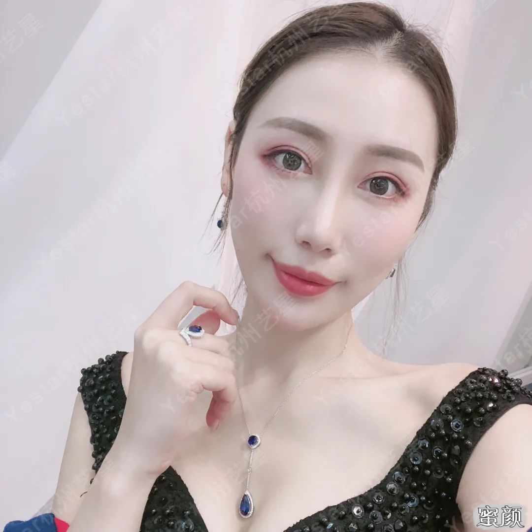 案例图片