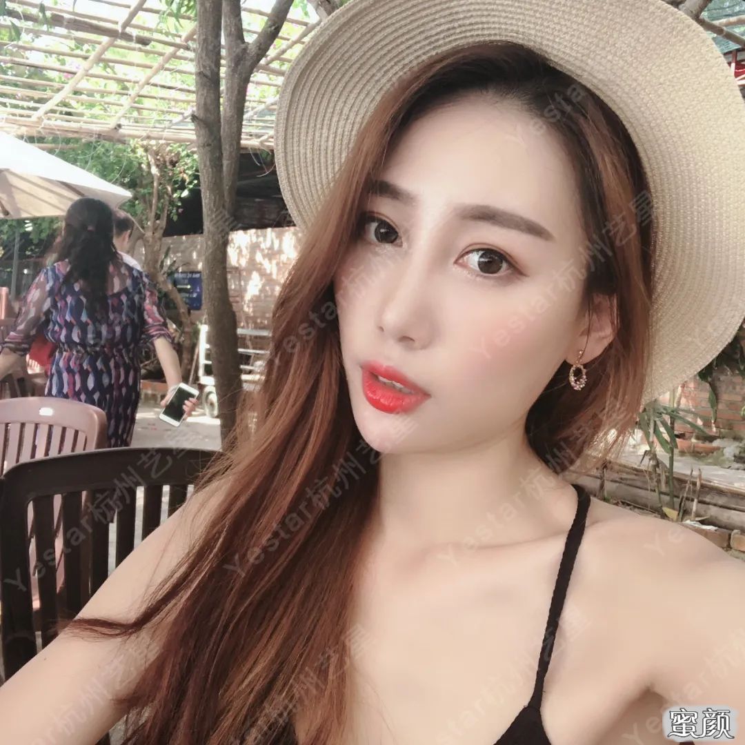 案例图片