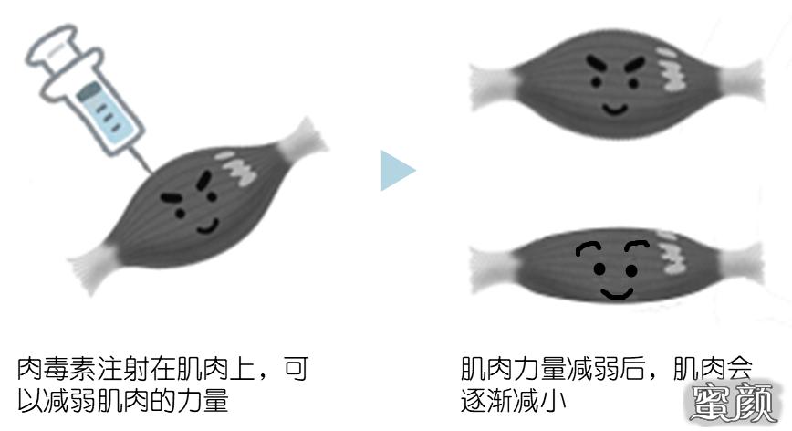 案例图片