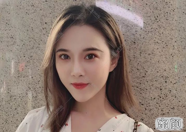 案例图片