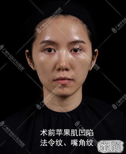 案例图片
