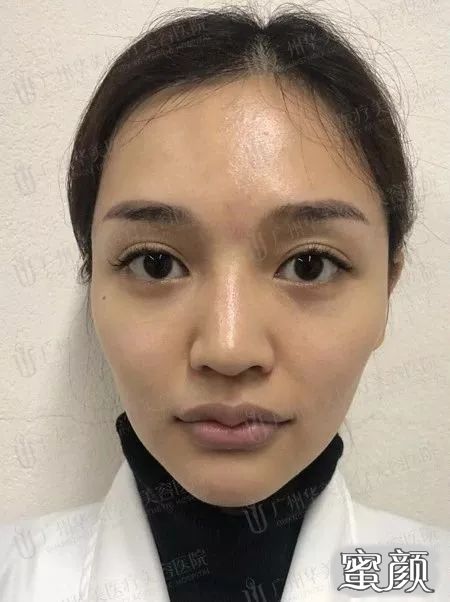 案例图片