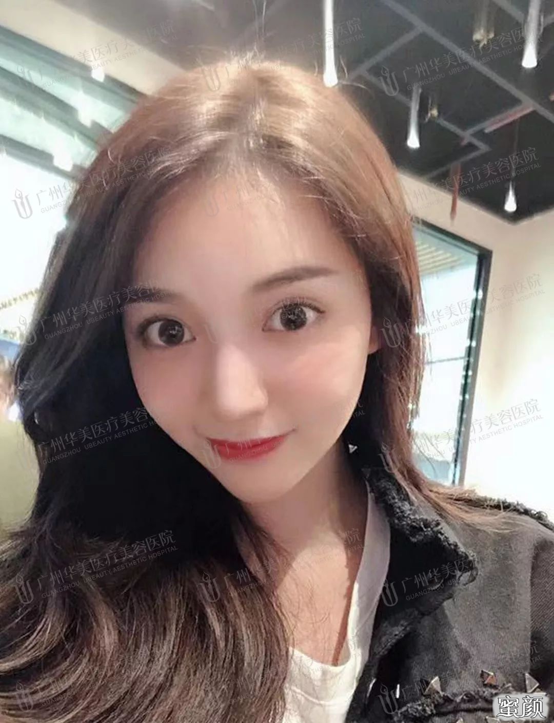 案例图片