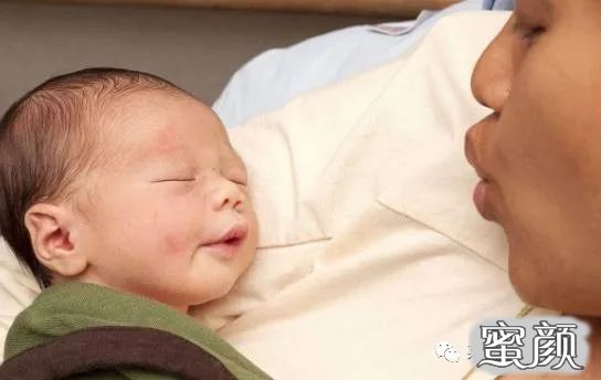 https://img.yiyiaimei.com/mnt/timg/200419/13133H0H-0.jpg 案例图片
