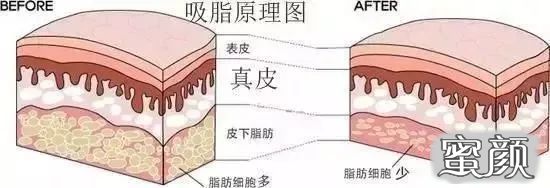 https://img.yiyiaimei.com/mnt/timg/200419/1352036006-4.jpg 案例图片