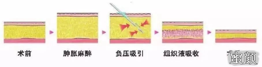 案例图片