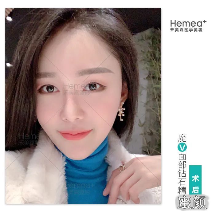 案例图片