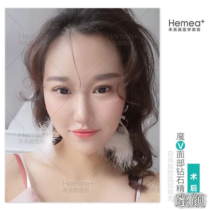案例图片