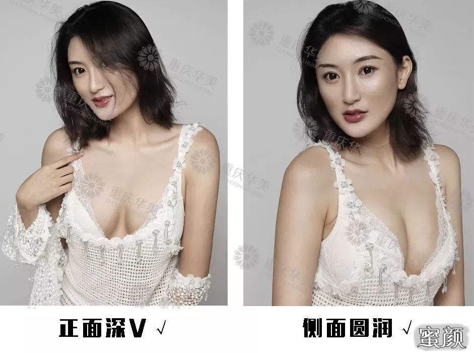 https://img.yiyiaimei.com/mnt/timg/200419/14194aV3-11.jpg 案例图片
