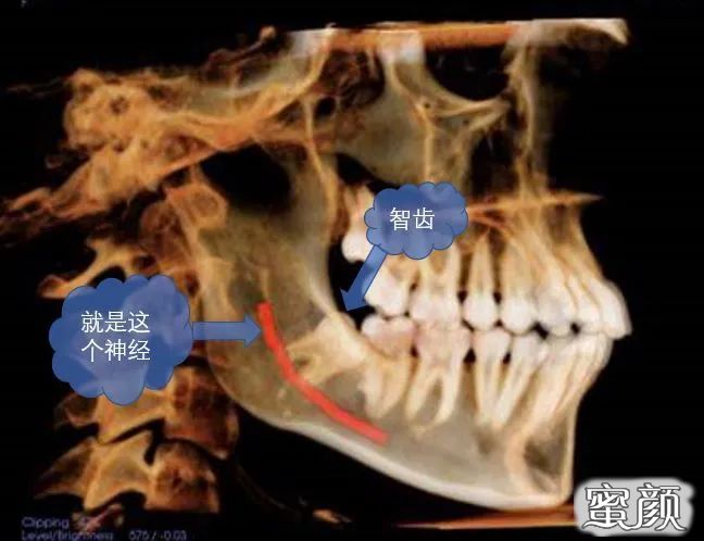 案例图片