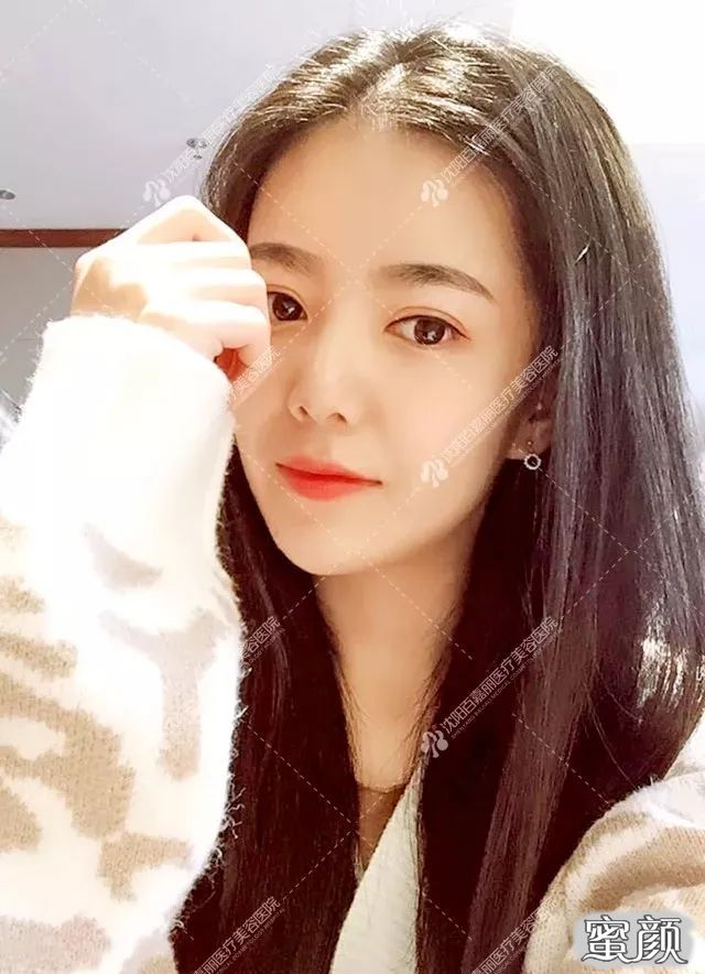 https://img.yiyiaimei.com/mnt/timg/200420/13012H3a-8.jpg 案例图片