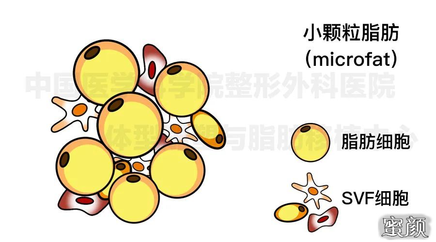 案例图片