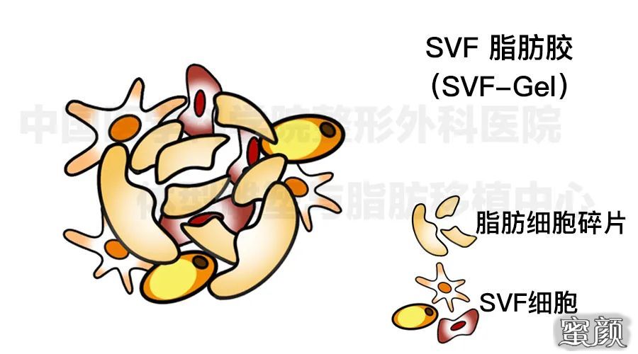 案例图片