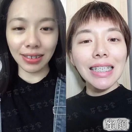 https://img.yiyiaimei.com/mnt/timg/200420/132524H38-4.jpg 案例图片