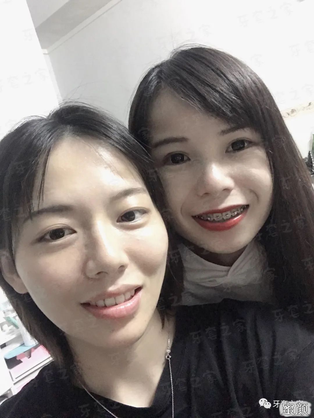 https://img.yiyiaimei.com/mnt/timg/200420/13252H358-7.jpg 案例图片