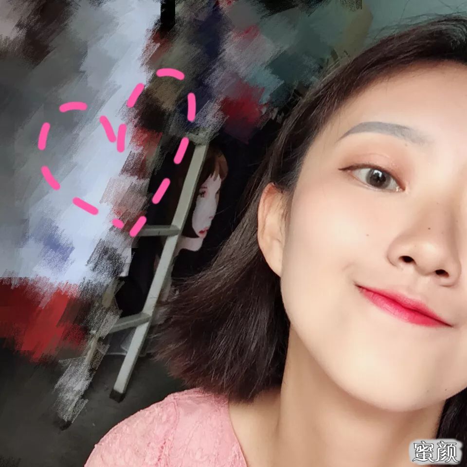 https://img.yiyiaimei.com/mnt/timg/200420/133I331C-10.jpg 案例图片