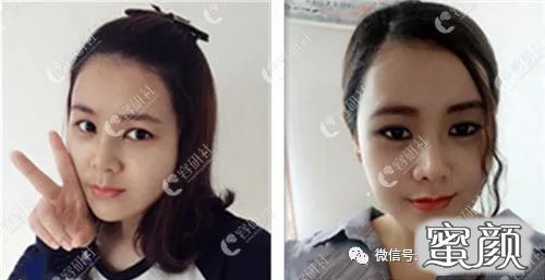 案例图片
