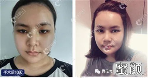 案例图片