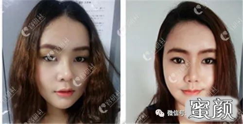 案例图片