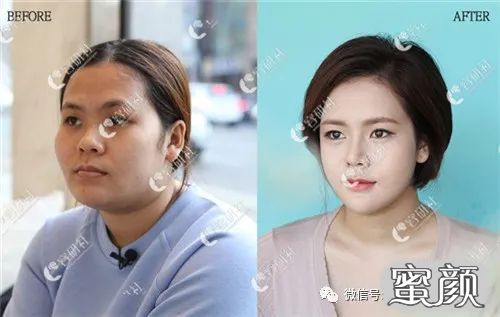 案例图片