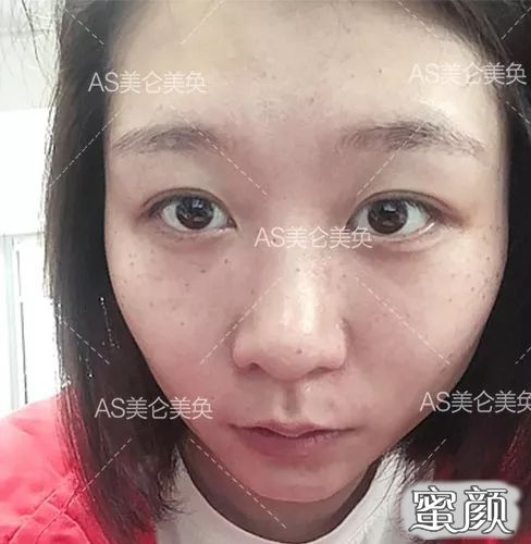 https://img.yiyiaimei.com/mnt/timg/200420/1344545925-2.jpg