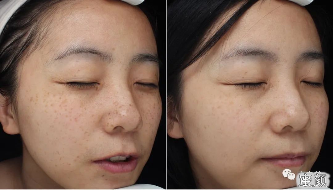 https://img.yiyiaimei.com/mnt/timg/200420/1359492453-2.jpg