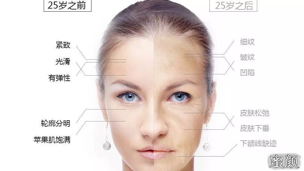 https://img.yiyiaimei.com/mnt/timg/200420/14040014a-5.jpg 案例图片