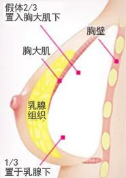 https://img.yiyiaimei.com/mnt/timg/200420/1411043910-10.jpg