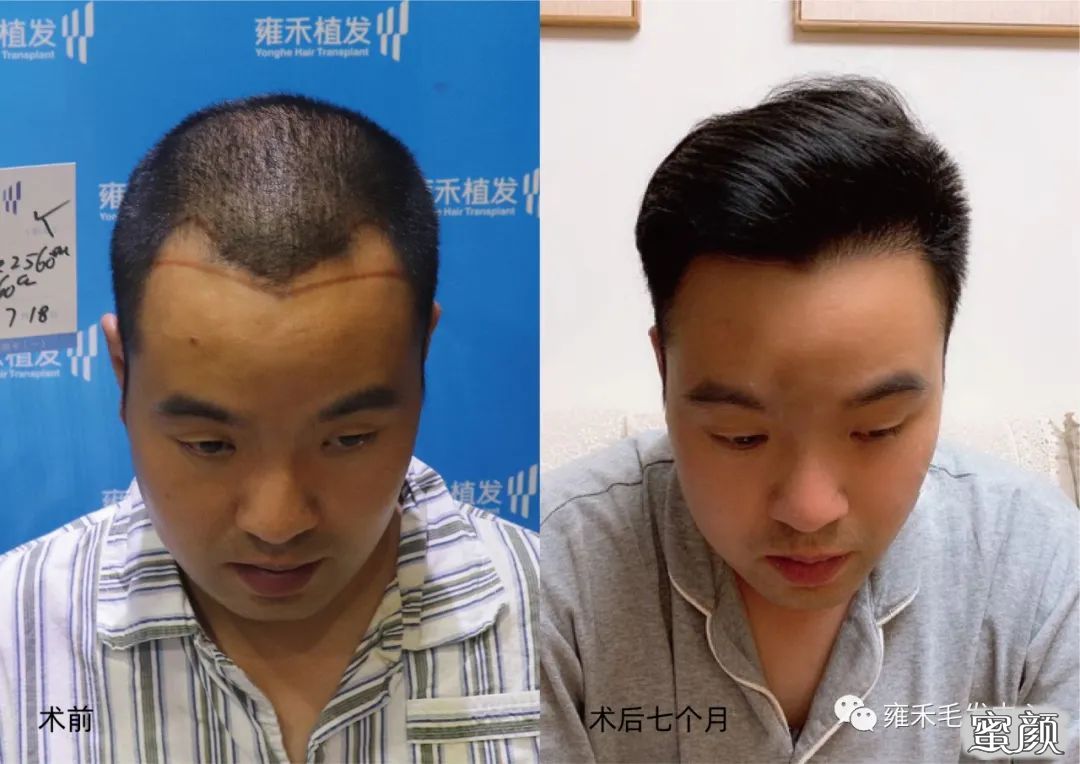 案例图片