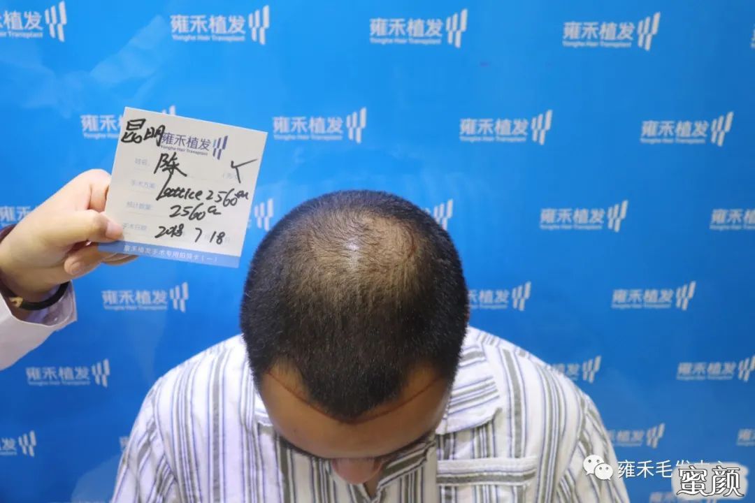 案例图片