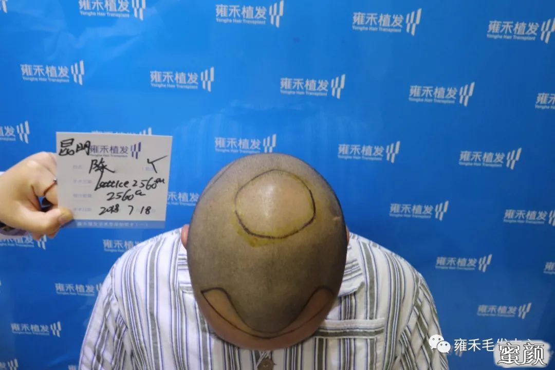 案例图片