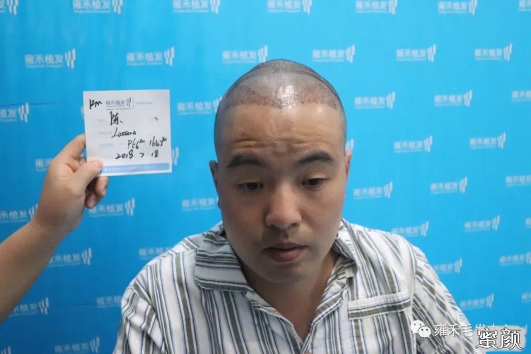 案例图片