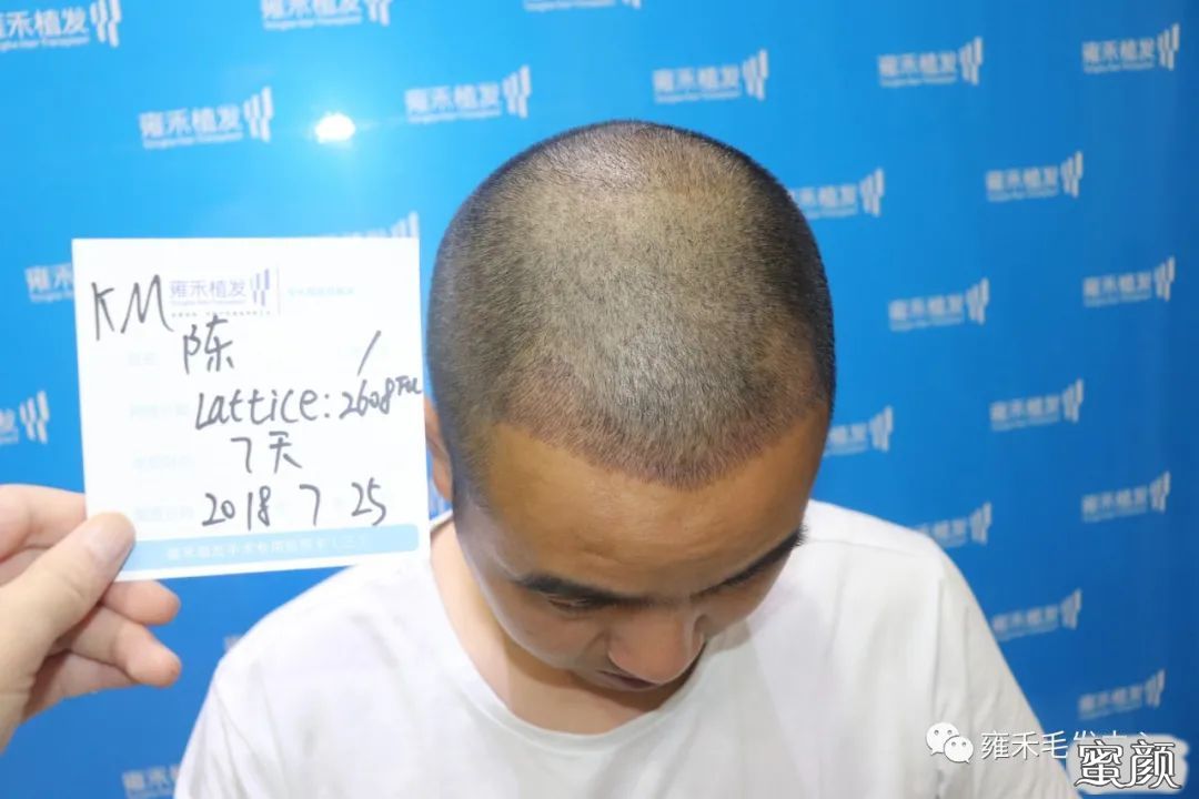 案例图片