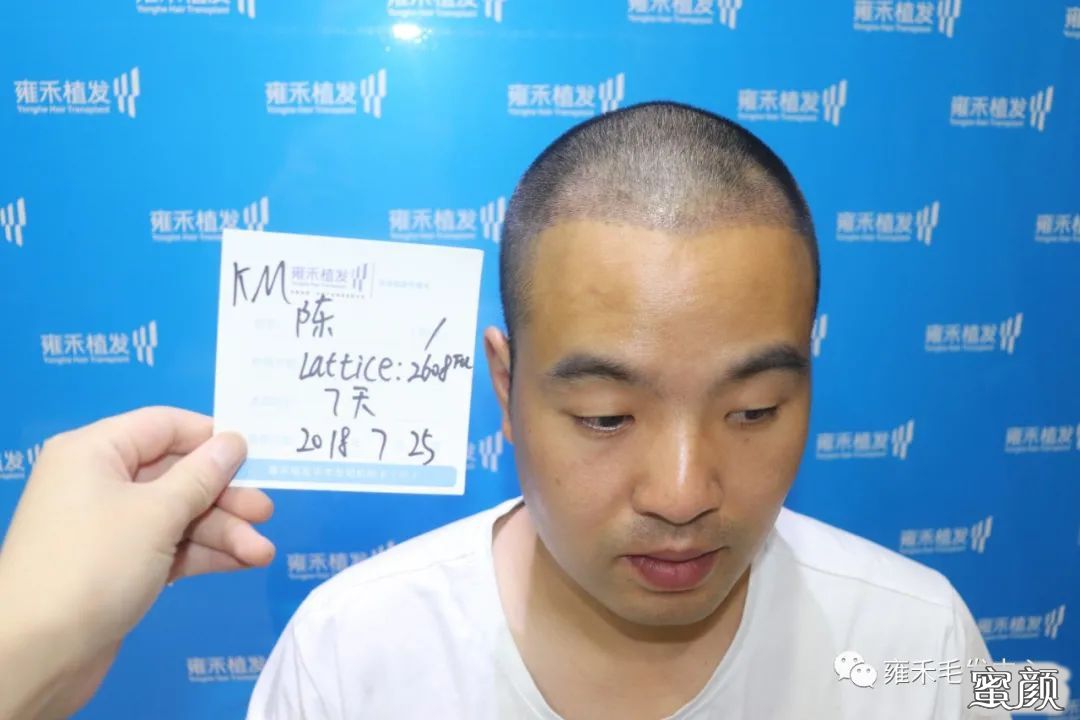 案例图片