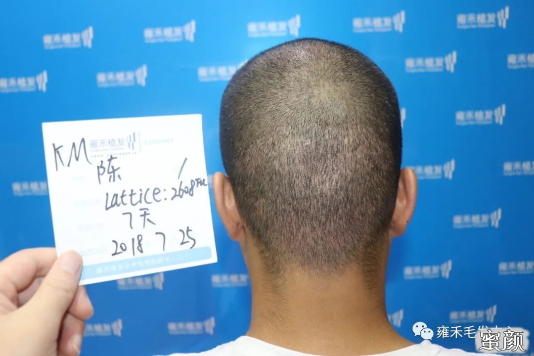 案例图片