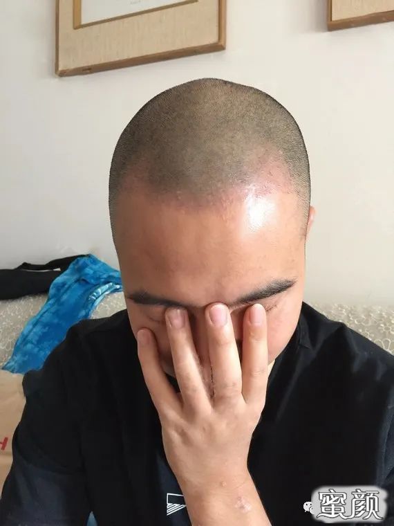 案例图片