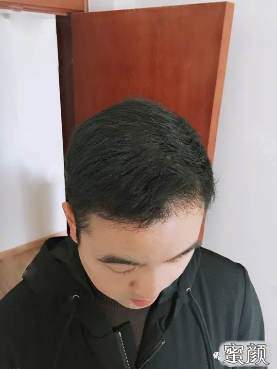 案例图片