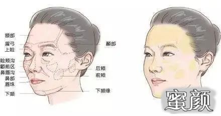 https://img.yiyiaimei.com/mnt/timg/200421/115R96335-0.jpg 案例图片