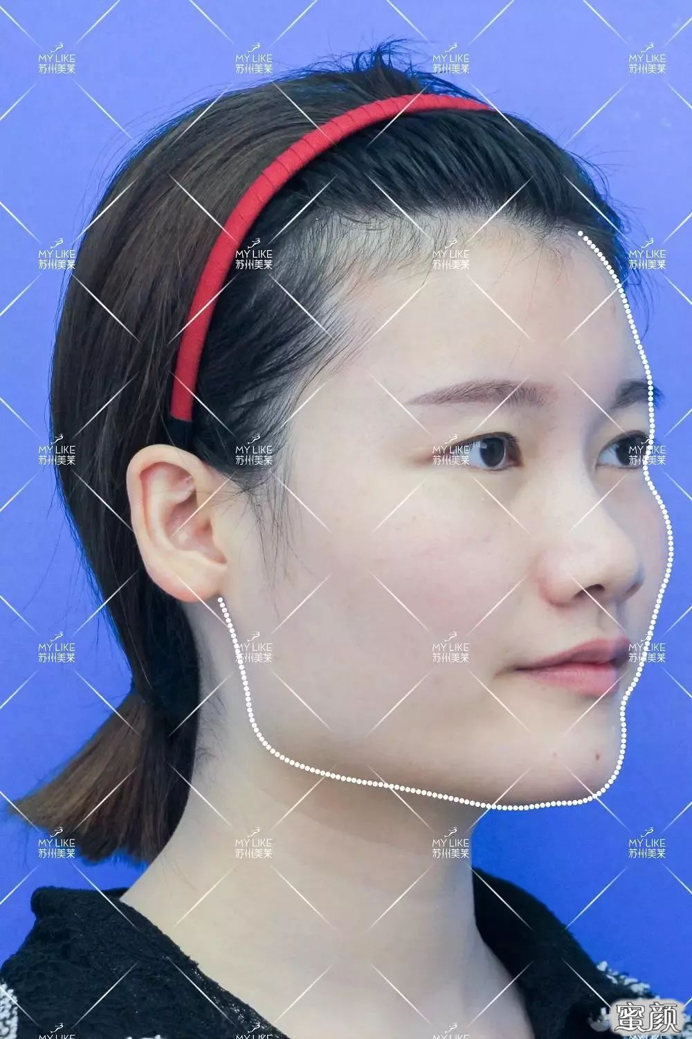 案例图片