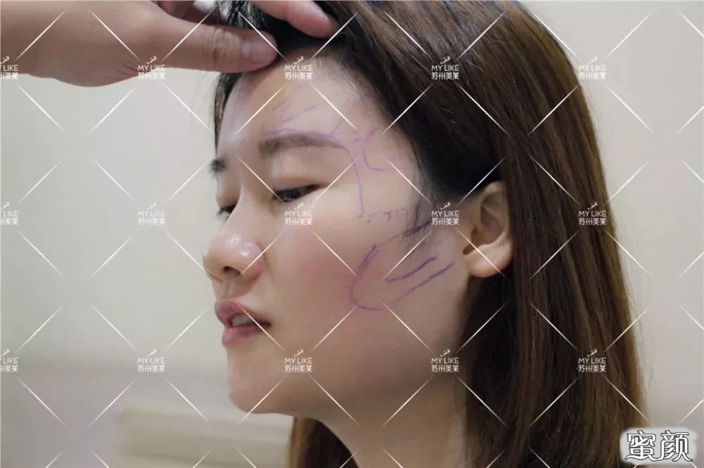 案例图片