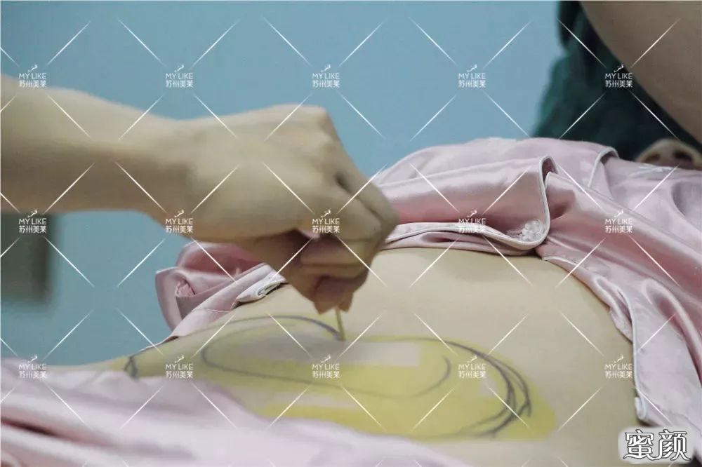 案例图片