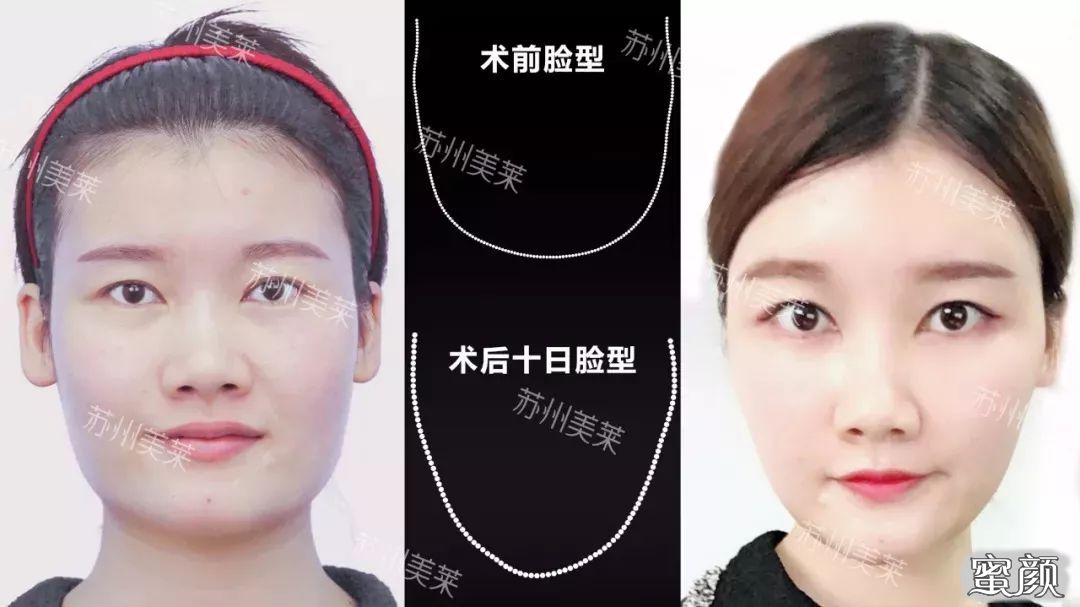 案例图片