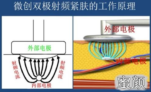 案例图片