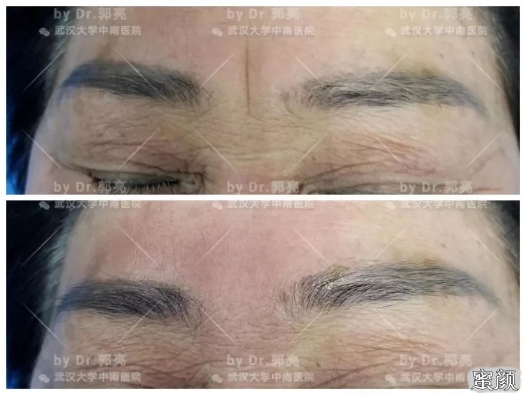 案例图片