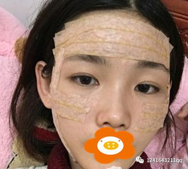 案例图片