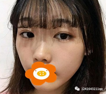 案例图片