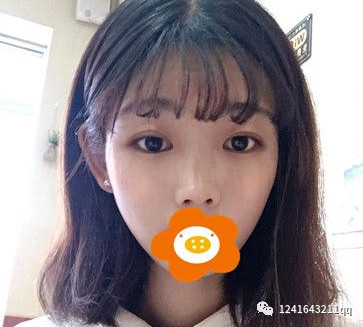 案例图片