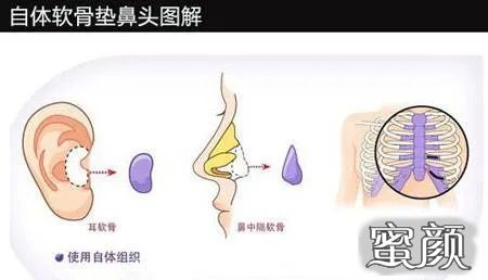 案例图片