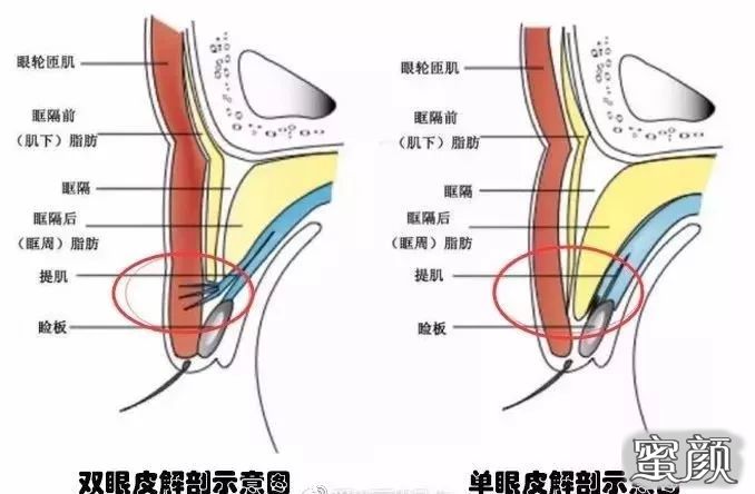 案例图片